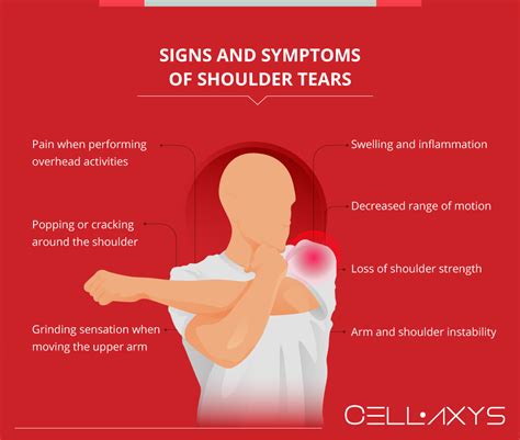 shoulder tear labrum treatment